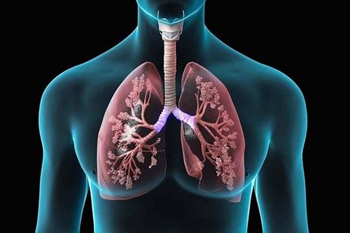 Dấu hiệu và cách phòng chống bệnh lao phổi