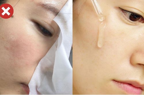 4 sản phẩm làm đẹp rất hại da và đẩy nhanh tốc độ lão hóa