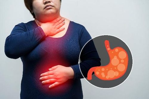 Trào ngược dạ dày- thực quản: Những dấu hiệu cảnh báo cần phải gặp bác sĩ