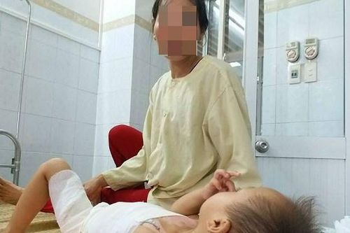 Trẻ em trước nguy cơ bỏng