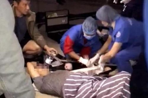 Bước ra từ thang máy tầng 2 chung cư, người đàn ông hụt chân rơi xuống sảnh