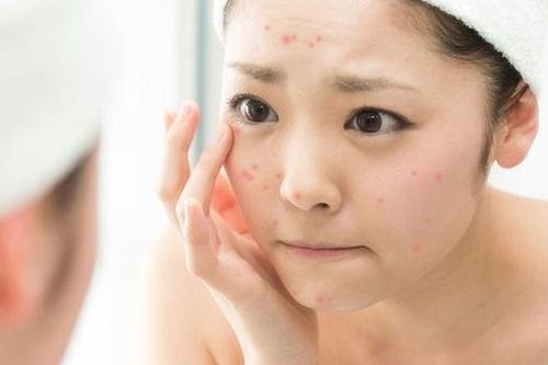Khắc phục phản ứng do da nhạy cảm