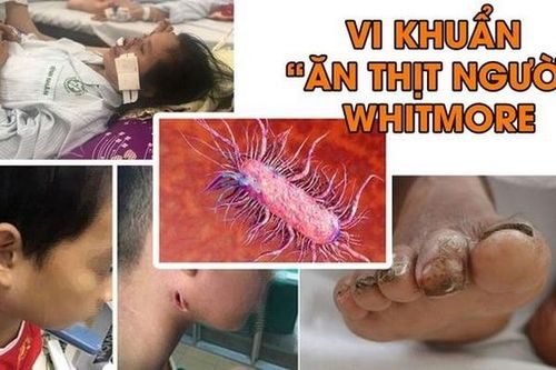 Cảnh giác với bệnh do vi khuẩn Whitmore gây ra sau lũ lụt