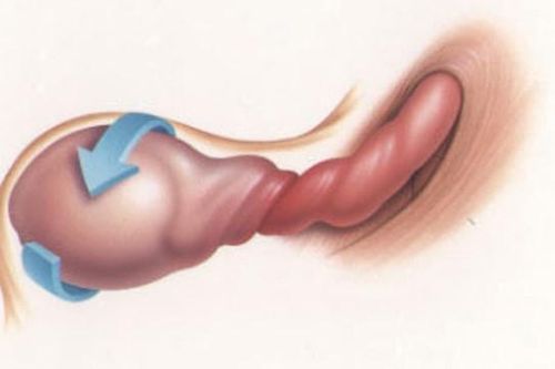 Ẩn tinh hoàn trẻ em – Hành trình đi tìm 'hòn ngọc' cho bé phát triển bình thường