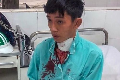 Cứa cổ tài xế xe ôm công nghệ để cướp tài sản?