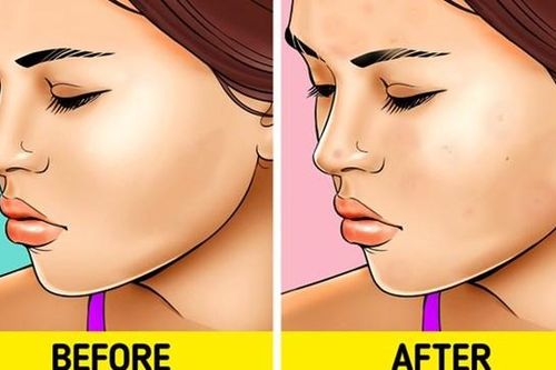 Trang điểm khi ngủ - lợi hay hại?