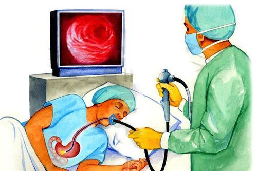 Khi nào cần nội soi dạ dày?