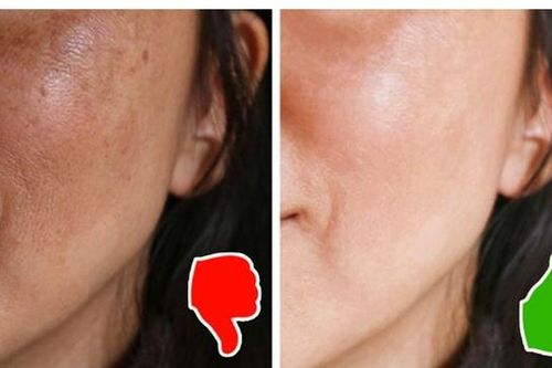 Điều gì sẽ xảy ra nếu bạn chỉ rửa mặt mỗi ngày một lần?