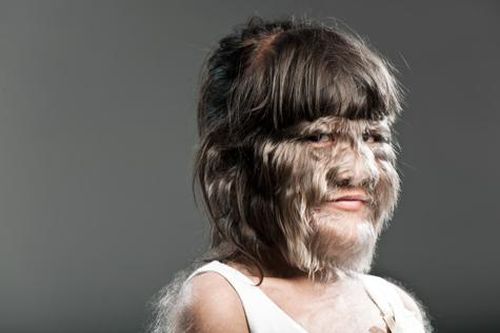 Top 10 dị nhân 'lông lá' nhất hành tinh