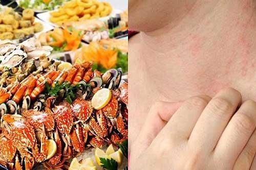 7 kiểu người tuyệt đối không nên ăn hải sản