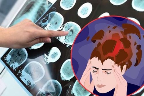 Bí quyết phòng đột quỵ của người Nhật khi trời trở lạnh