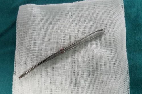 Cây nhíp đâm từ miệng lên mũi bé trai 10 tuổi