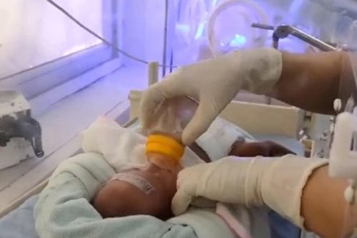 Bé gái ở Tuyên Quang chào đời chỉ nặng 0,6 kg