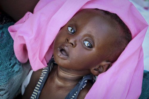 Nguy cơ nạn đói bùng phát ở Nam Sudan