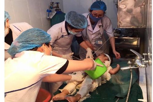 Dùng nước mắm và rượu chữa bỏng, một bé trai bị nhiễm trùng nặng