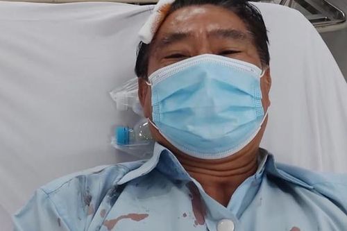 Sếp cơ sở cai nghiện ma túy Bình Triệu bị nhân viên hành hung giữa cuộc họp