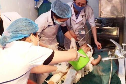 Chữa bỏng bằng nước mắm và rượu, bé trai 2 tuổi bị nhiễm trùng nặng