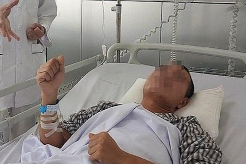 Người đàn ông 28 tuổi đột quỵ sau cơn đau đầu
