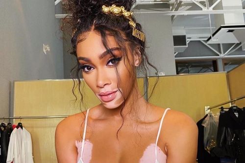 Người mẫu nội y Winnie Harlow tăng 11 kg