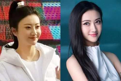 Cảnh Điềm phẫu thuật thẩm mỹ hỏng?