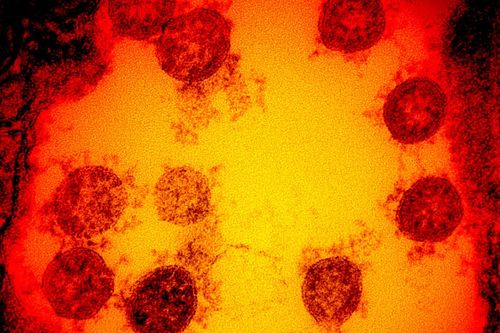 Phát hiện chủng mới của virus corona ở Anh