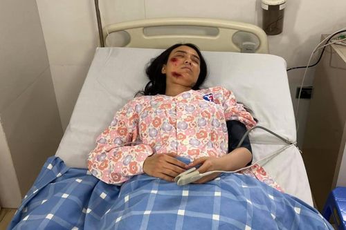 Sau phát ngôn phản cảm về sự ra đi của cố nghệ sĩ Chí Tài, hotgirl Linh Miu đăng ảnh đầy thương tích