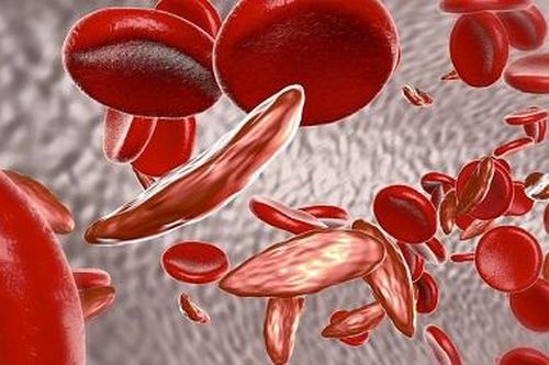 Điều trị các bệnh về máu nhờ liệu pháp chỉnh sửa gene