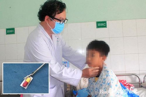 Suýt rách thực quản vì uống thuốc còn nguyên vỏ