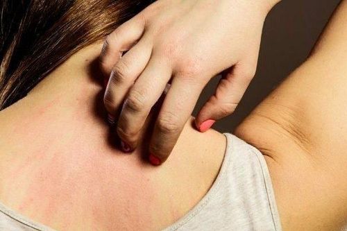 Bị ngứa ở những nơi này nên đi khám ngay kẻo mắc ung thư mà không biết