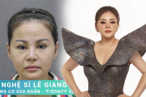 Lê Giang bức xúc khi bị người khác lấy ảnh mặt mộc kém sắc quảng cáo trái phép