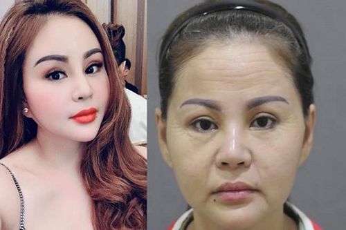 Bị đăng ảnh da nhăn nheo, nhan sắc Lê Giang ra sao hậu 'dao kéo'?