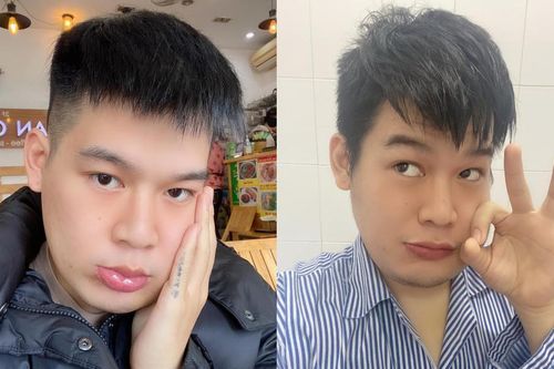 Hot TikToker Long Chun giữ tinh thần lạc quan sau 1 tháng điều trị u men xương hàm