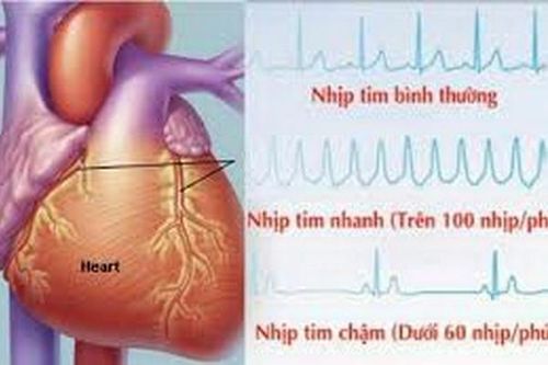 Rủi ro tiềm ẩn khi dùng thuốc chống rối loạn nhịp tim