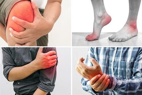 Thuốc giảm đau, viêm xương khớp: Cần đề phòng các bất lợi khi dùng
