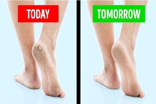 Mẹo hay giúp đôi bàn chân luôn nuột nà, hoàn hảo bất chấp giá rét