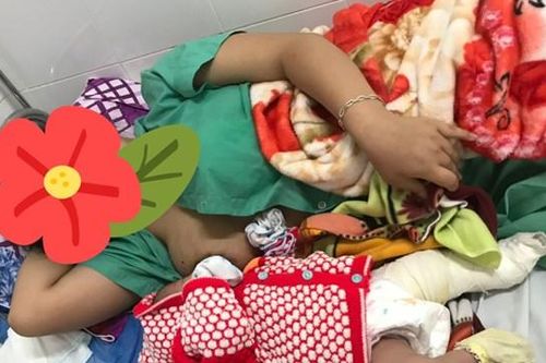 Quảng Nam: Một bé trai gãy xương đùi sau khi được sinh mổ