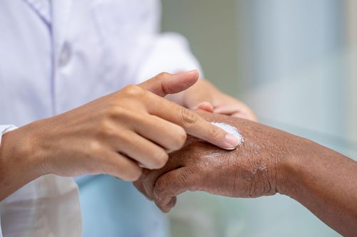 Những căn bệnh ngoài da dễ bùng phát vào mùa lạnh