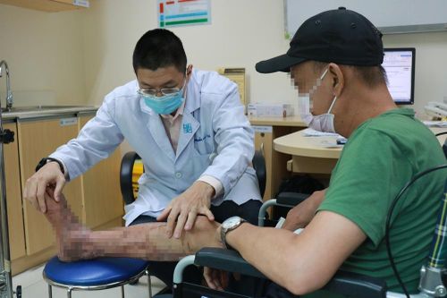 Bệnh nhân bị hoại tử chân do dùng dầu nóng xoa vết thương
