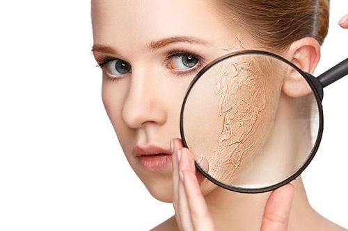 Làm gì để tránh bị da khô, nứt nẻ trong mùa đông?