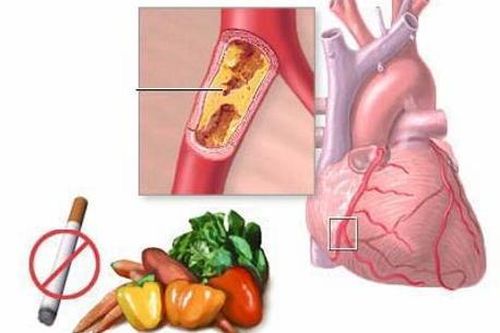 Hút thuốc lá sẽ ảnh hưởng đến tim