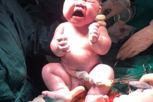 Em bé gần 6kg chào đời tại bệnh viện tuyến đầu chống dịch