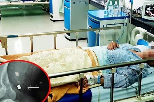 Cứu sống người đàn ông bị 'đạn lạc' găm vào đùi ở Quảng Nam
