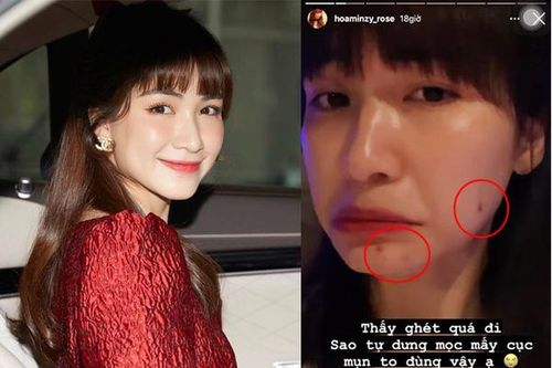 Một phút lầm lỡ bị mụn hành, Hòa Minzy thất thế ngôi vương, mặt mộc không tì vết