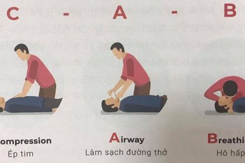 Thời gian vàng là bao lâu để cứu 'não' khi bị đột quỵ