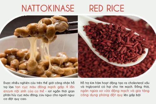 Cảnh giác đột quỵ sau cơn thiếu máu não thoáng qua khi trời trở lạnh