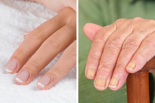 7 bộ phận cơ thể 'tố cáo' tuổi thật mà bạn không thể giấu