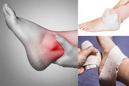 Cách phòng tránh bong gân khi tập thể thao