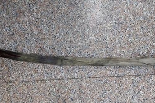 Bị cọc gỗ đâm xuyên tầng sinh môn 30cm