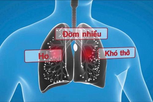 Một số phương thuốc hay chữa đàm nhiệt khái thấu