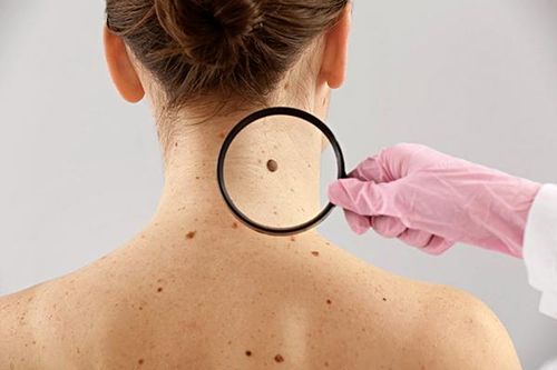 Những nghiên cứu hứa hẹn trong điều trị ung thư da